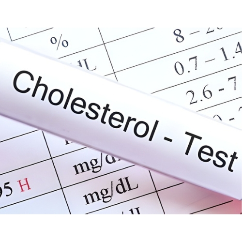 Cholestrol Total