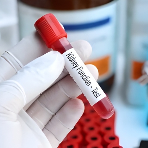 Kidney Function Test