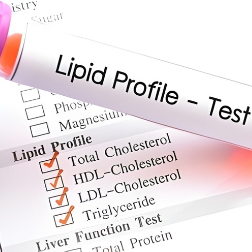 Lipid Profile
